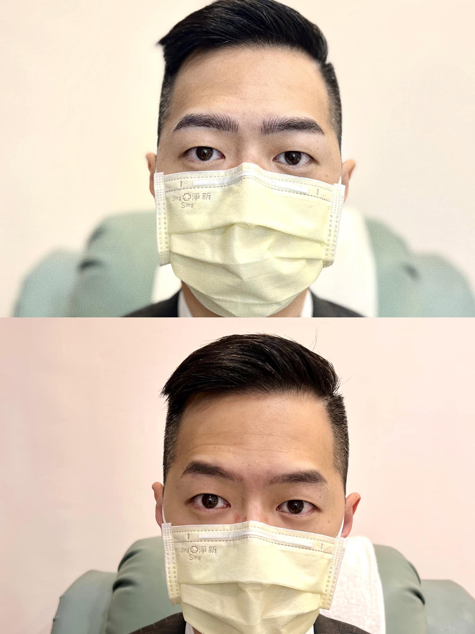 紋繡眉部對比-男生